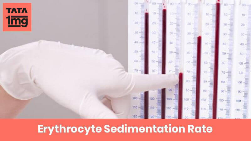 Erythrocyte Sedimentation Rate
